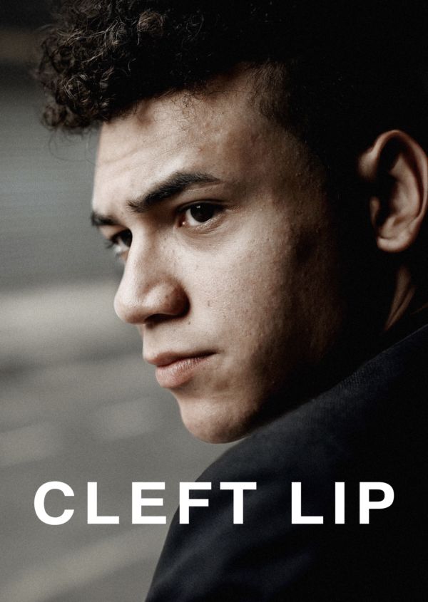 Cleft Lip on Disney+ ES