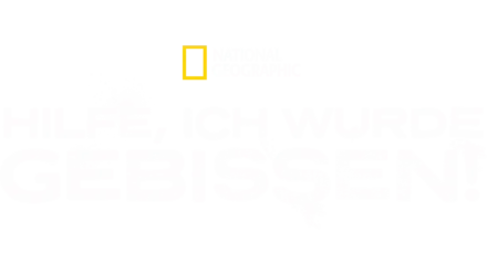 Hilfe, ich wurde gebissen!